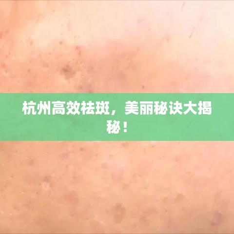 杭州高效祛斑，美麗秘訣大揭秘！