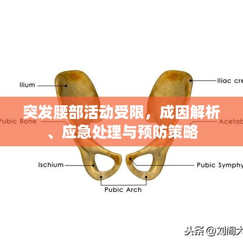 突發(fā)腰部活動(dòng)受限，成因解析、應(yīng)急處理與預(yù)防策略