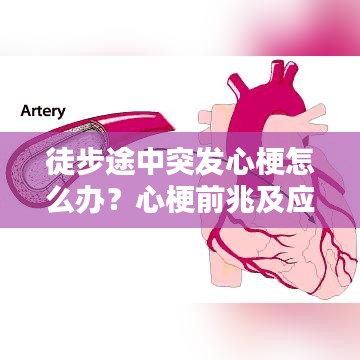 徒步途中突發(fā)心梗怎么辦？心梗前兆及應對措施科普！