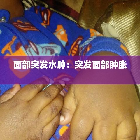 面部突發(fā)水腫：突發(fā)面部腫脹 