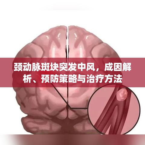 頸動(dòng)脈斑塊突發(fā)中風(fēng)，成因解析、預(yù)防策略與治療方法